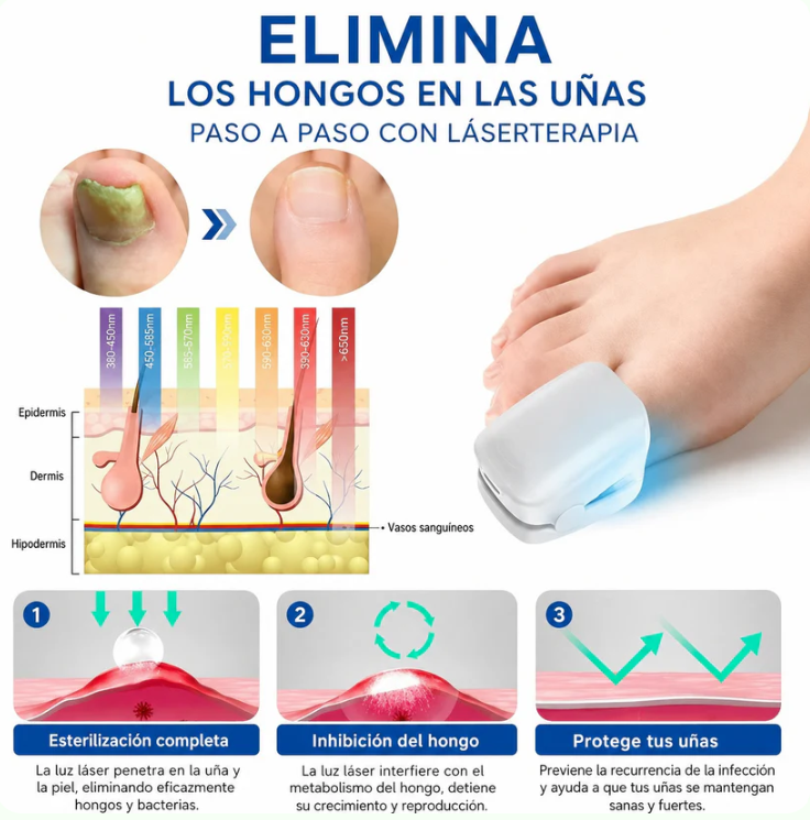 OnyCure™ – Elimina los hongos de raíz y recupera tus uñas desde el primer día