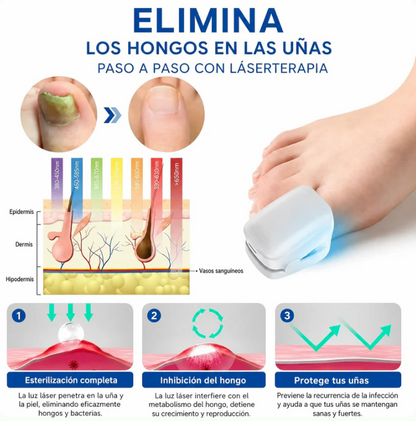 OnyCure™ – Elimina los hongos de raíz y recupera tus uñas desde el primer día