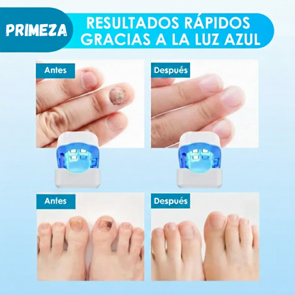 Di Adiós a Los Hongos Desde el Primer Día - OnyVera